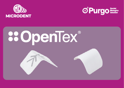 Opentex